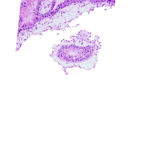 cephalic edge of amniotic cavity, epiblast, mesoblast (mesenchyme), primordial blood vessel(s)