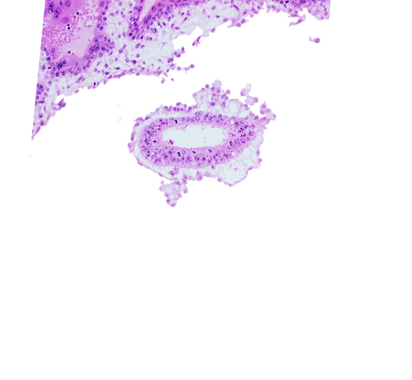 cephalic part of amniotic cavity, mesoblast (mesenchyme)