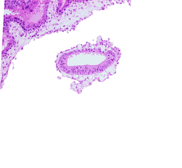 amniotic cavity, chorionic cavity, mesoblast, primordial blood vessel(s)