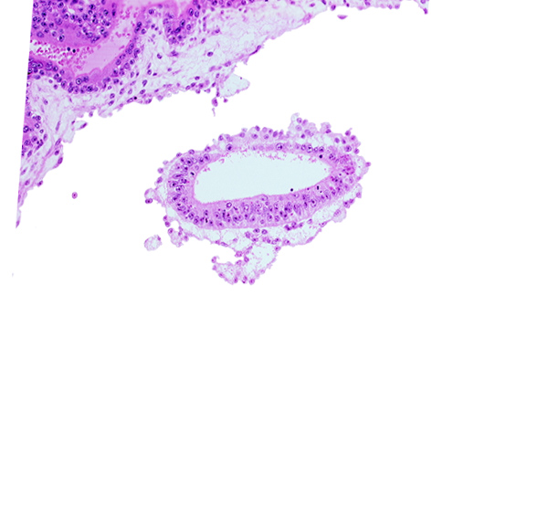 amniotic cavity, cephalic edge of amnion, epiblast, mesoblast
