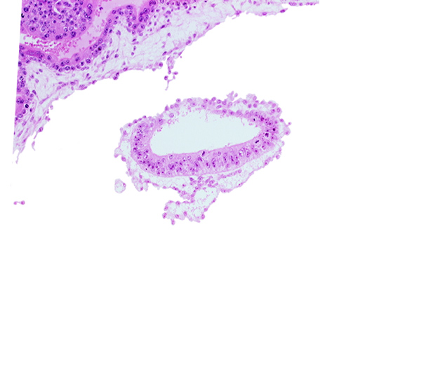 amniotic cavity, cephalic part of amnion, epiblast, mesoblast