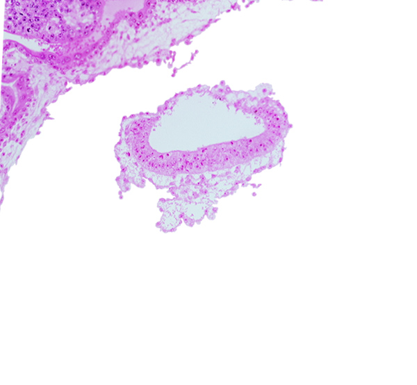 amnion, cephalic part of connecting stalk, head mesenchyme