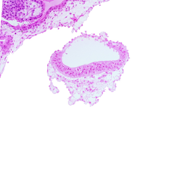 amnion, amniotic cavity, extra-embryonic mesoblast (somatopleuric layer), head mesenchyme