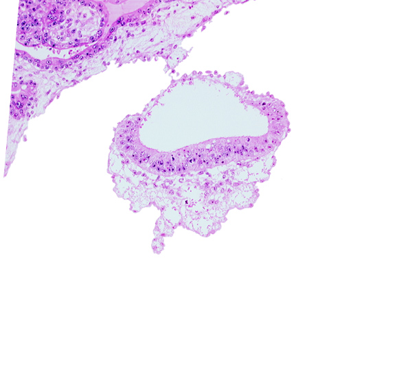 amnion, amniotic cavity, embryonic disc, extra-embryonic mesoblast (somatopleuric layer)