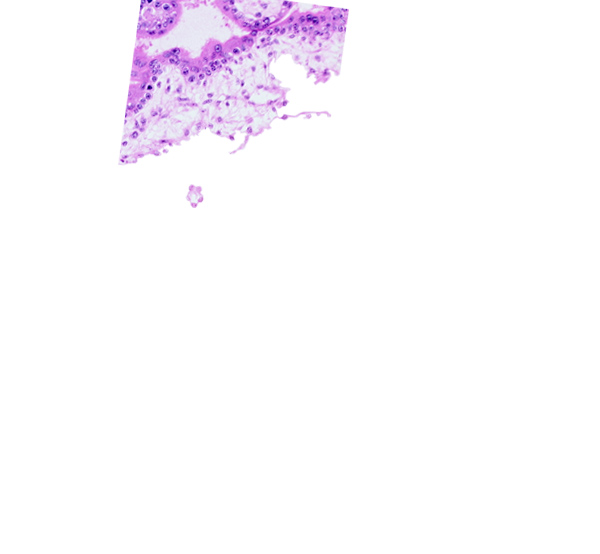 chorion, chorionic cavity (extra-embryonic coelom or exocoelom), extra-embryonic mesoblast, floating villus, intervillus space(s)