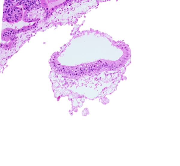 amnion, amniotic cavity, connecting stalk, epiblast, extra-embryonic endoderm, extra-embryonic mesoblast, head mesenchyme, hypoblast, umbilical vesicle cavity