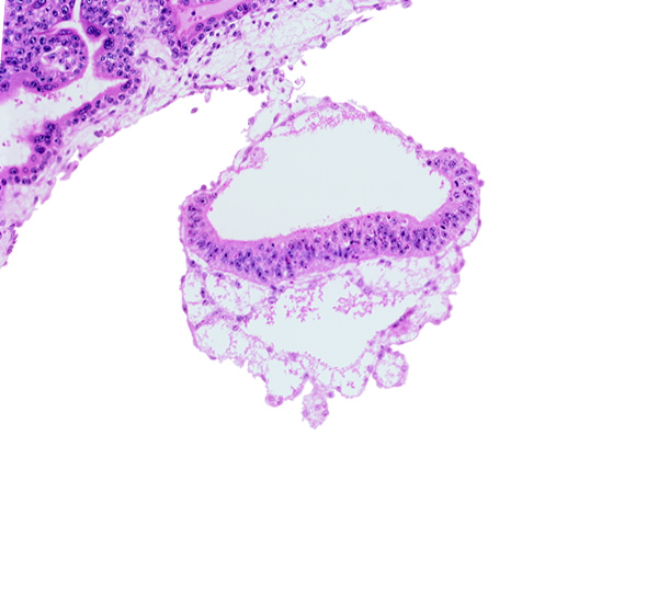 amnion, amniotic cavity, connecting stalk, epiblast, extra-embryonic endoderm, extra-embryonic mesoblast, umbilical vesicle cavity