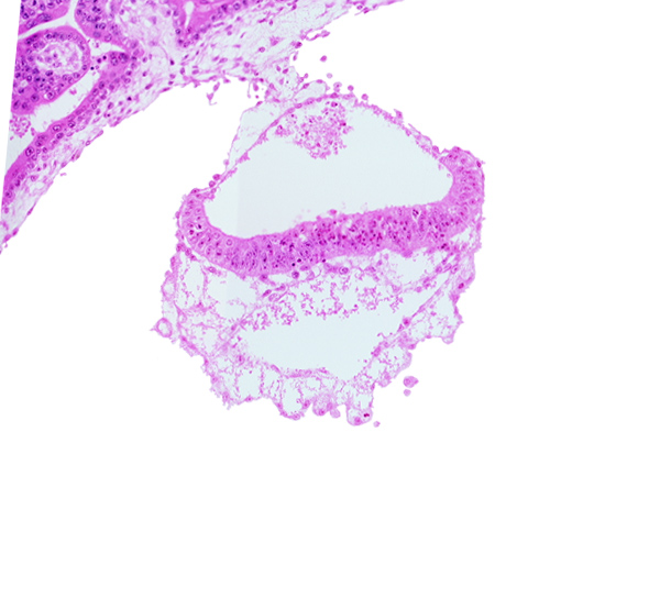 connecting stalk, extra-embryonic coelom, junction of amnion and epiblast plate, primordial blood vessel(s), two-layered amnion, umbilical vesicle wall