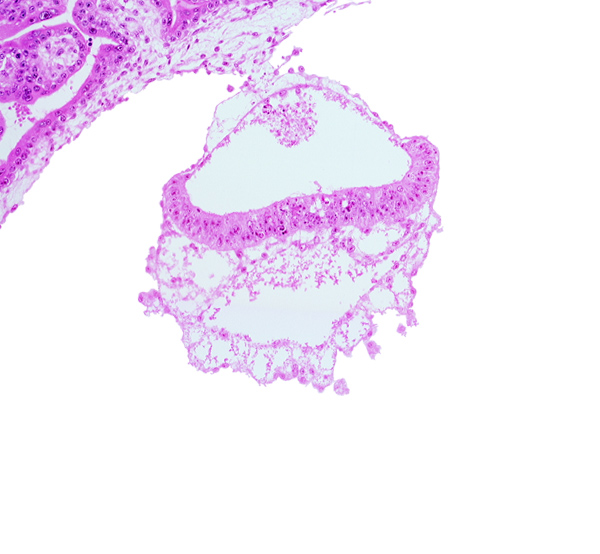 connecting stalk, extra-embryonic coelom, junction of amnion and epiblast plate, two-layered amnion, umbilical vesicle wall