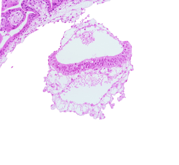 connecting stalk, epiblast, extra-embryonic coelom, head mesenchyme, hypoblast, junction of amnion and epiblast plate, two-layered amnion, umbilical vesicle wall
