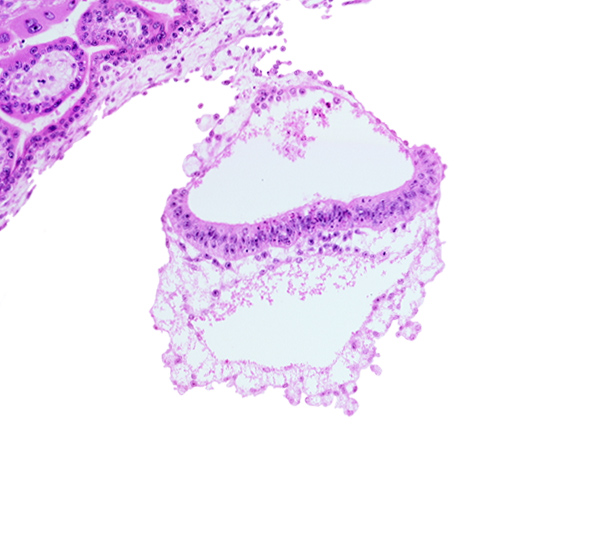 connecting stalk, epiblast, head mesenchyme, hypoblast, mesoblast, notochordal process, presumptive neural plate