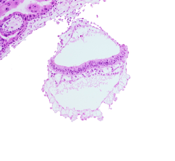 amniotic mesenchyme, epiblast, hemangiogenic tissue, hypoblast, junction of embryonic and extra-embryonic mesoblast, notochordal process, presumptive neural plate, two-layered amnion, umbilical vesicle wall