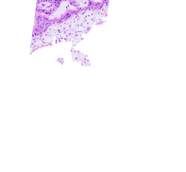 cephalic edge of connecting stalk, chorionic cavity, extra-embryonic mesoblast