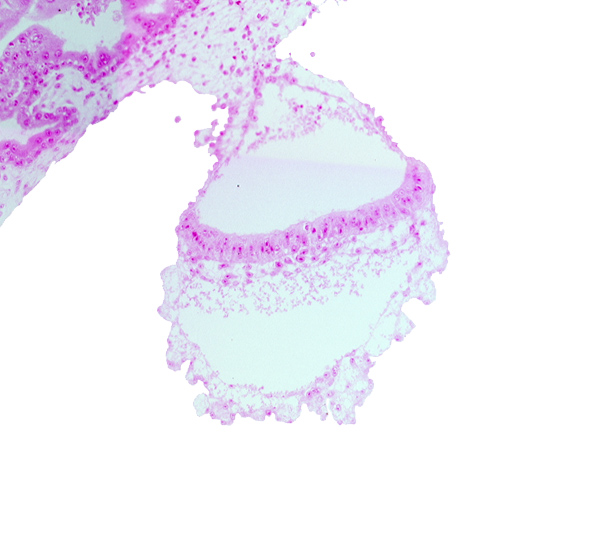 amniotic mesenchyme, connecting stalk, gastrulation (primitive) node, head mesenchyme, hypoblast, lateral edge of embryonic disc, mesothelium