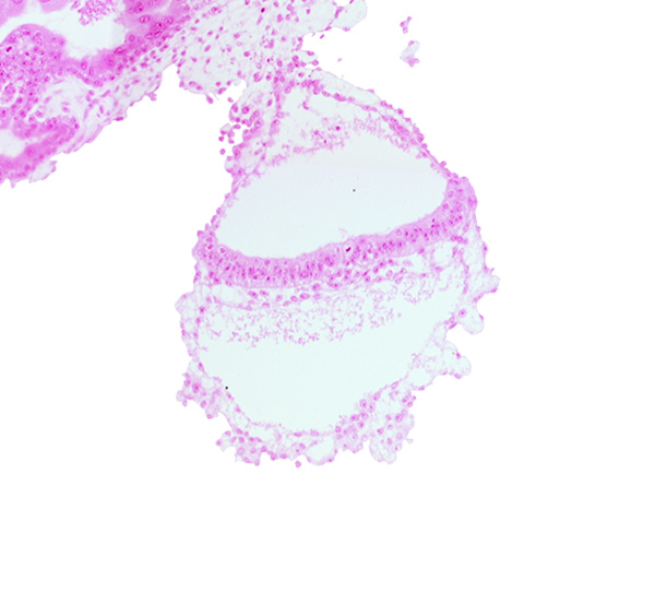 amniotic mesenchyme, connecting stalk, gastrulation (primitive) node, head mesenchyme, lateral edge of embryonic disc, mesothelium