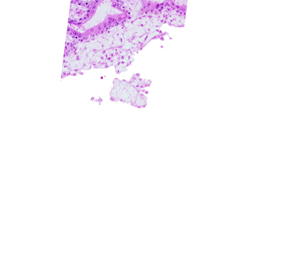 cephalic edge of connecting stalk, chorionic cavity, extra-embryonic mesoblast