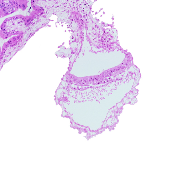 connecting stalk, cyst in umbilical vesicle wall, embryonic endoderm, embryonic mesoderm, gastrulation (primitive) streak, lateral edge of embryonic disc, middle part of amniotic duct, presumptive angioblastic tissue