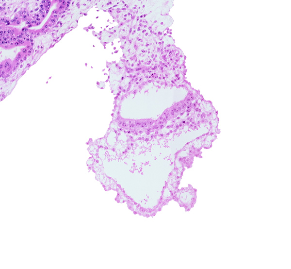 connecting stalk, embryonic endoderm, embryonic mesoderm, epiblast, extra-embryonic endoderm, gastrulation (primitive) groove, gastrulation (primitive) streak