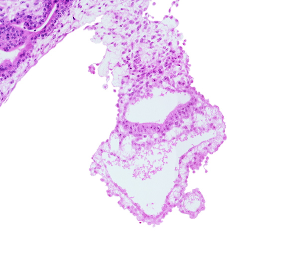 connecting stalk, embryonic endoderm, embryonic mesoderm, epiblast, extra-embryonic endoderm, gastrulation (primitive) groove, gastrulation (primitive) streak