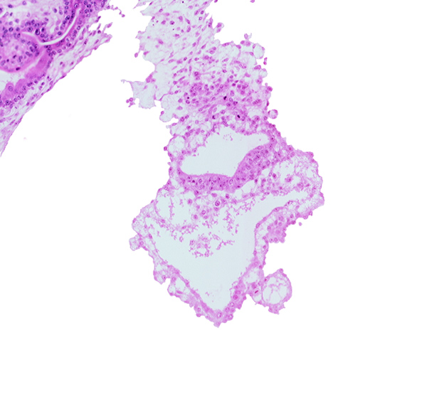 amniotic cavity, cephalic edge of dermatomyotome 3 (O-3), cephalic parts of conus cordis, gastrulation (primitive) groove, umbilical vesicle cavity