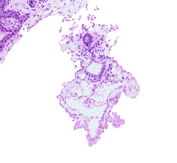 amniotic cavity, caudal part of external cyst, distal part of allantoic diverticulum, embryonic endoderm, embryonic mesoderm, internal cyst, umbilical vesicle cavity, umbilical vesicle wall