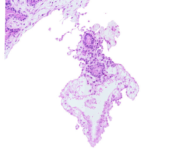 allantoic diverticulum (duct), cephalic edge of amnion, cloacal membrane, embryonic endoderm, internal cyst, umbilical vesicle cavity