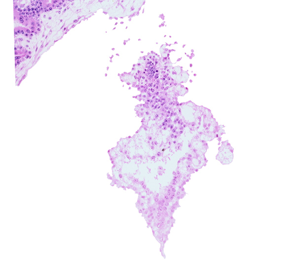allantoic diverticulum (duct), allantoic mesenchyme, presumptive angioblastic tissue