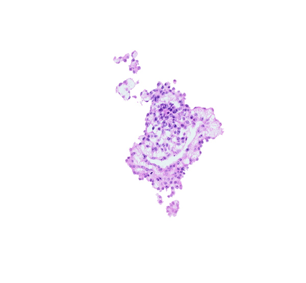 allantoic diverticulum (duct), allantoic mesenchyme, hemangiogenic tissue, umbilical vesicle cavity