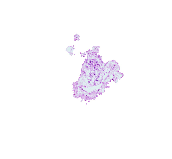 allantoic diverticulum, caudal part of umbilical vesicle cavity, junction of mesenchyme in connecting stalk and umbilical vesicle wall