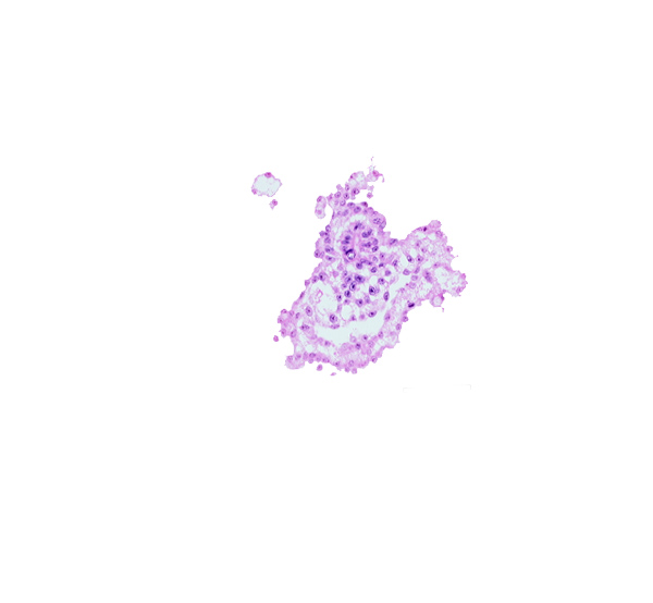 allantoic diverticulum, caudal part of umbilical vesicle cavity, junction of mesenchyme in connecting stalk and umbilical vesicle wall