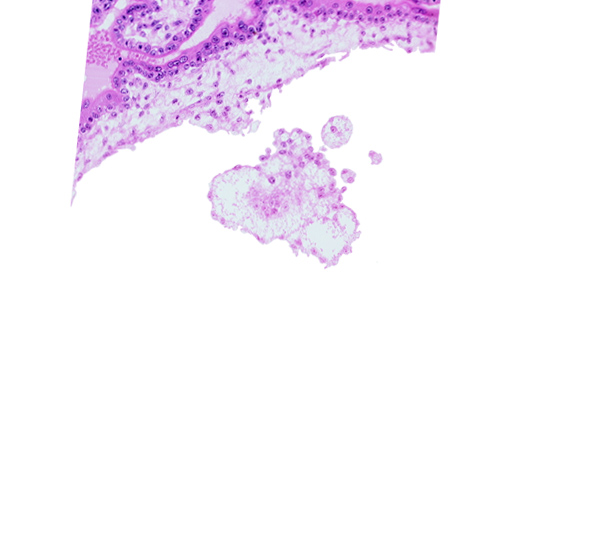 chorionic plate, extra-embryonic mesoblast, intervillus space(s)