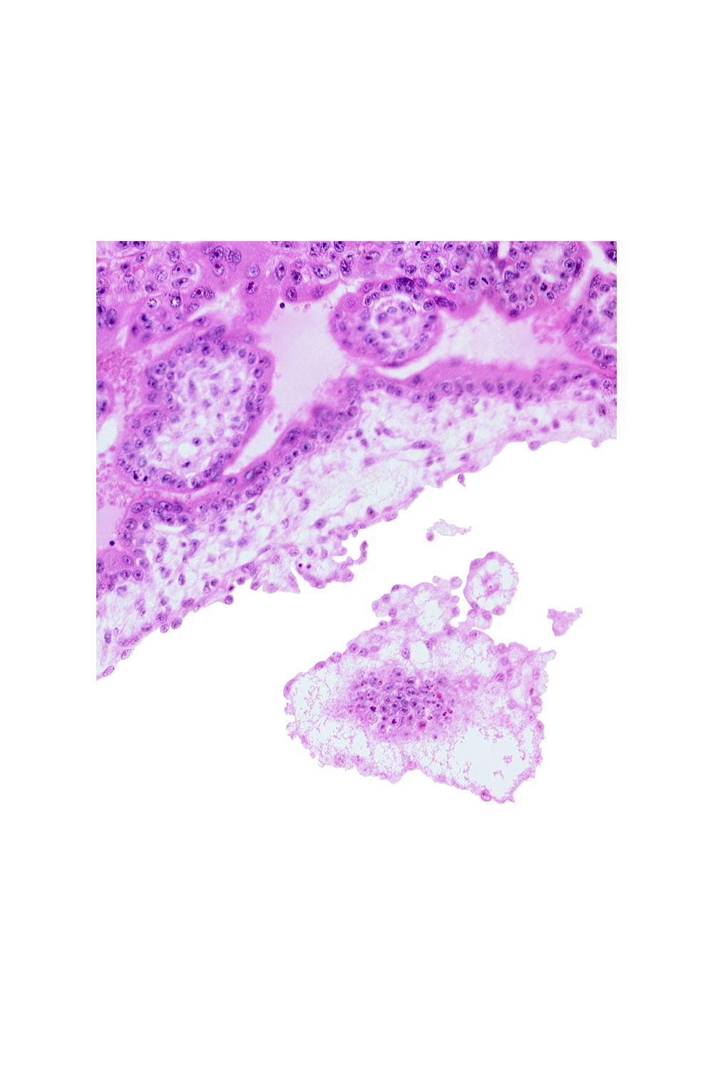 cephalic edge of embryonic disc, chorionic cavity