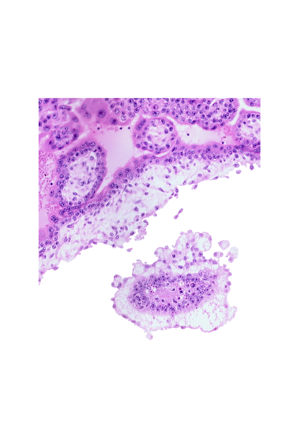 cephalic part of embryonic disc, chorionic cavity