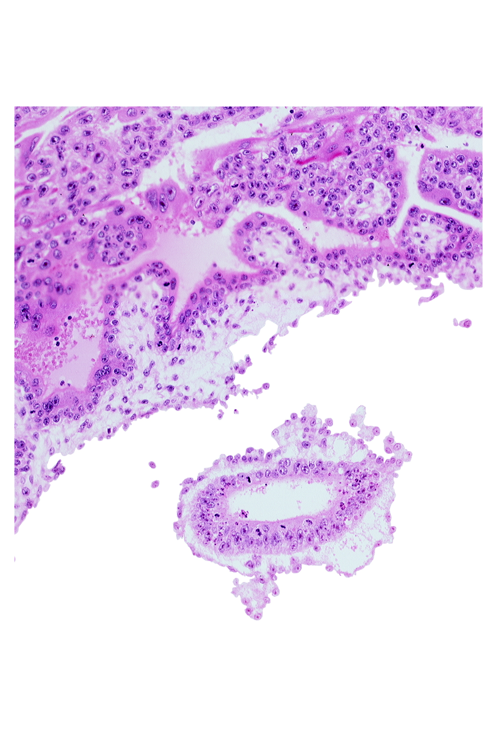 cephalic part of amniotic cavity, mesoblast (mesenchyme)