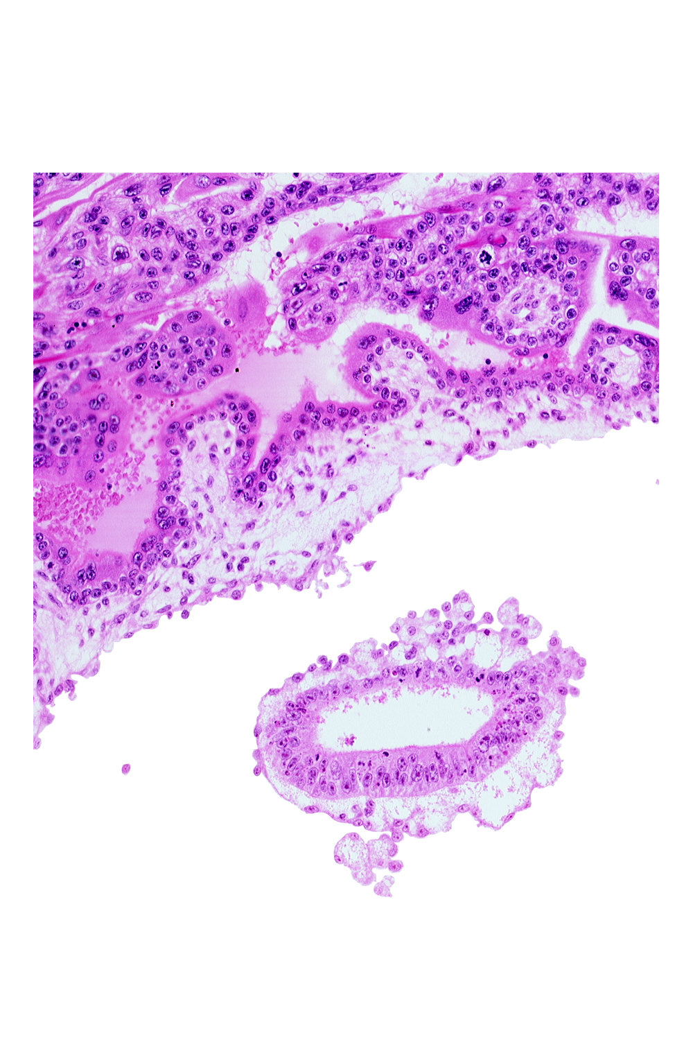 amniotic cavity, chorionic cavity, epiblast, mesoblast, primordial blood vessel(s)