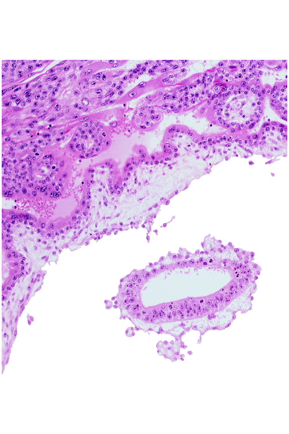 amniotic cavity, chorionic cavity, mesoblast