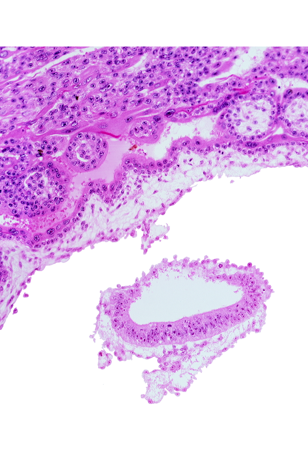 amnion, cephalic part of connecting stalk, head mesenchyme