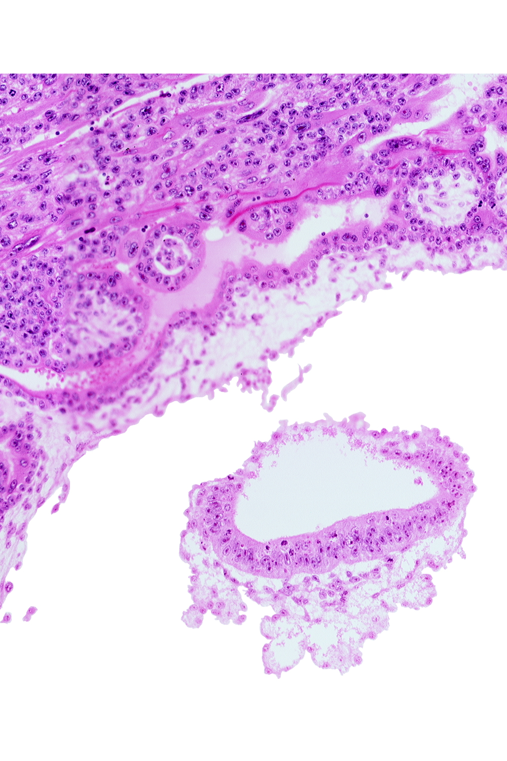 amnion, cephalic part of connecting stalk, head mesenchyme