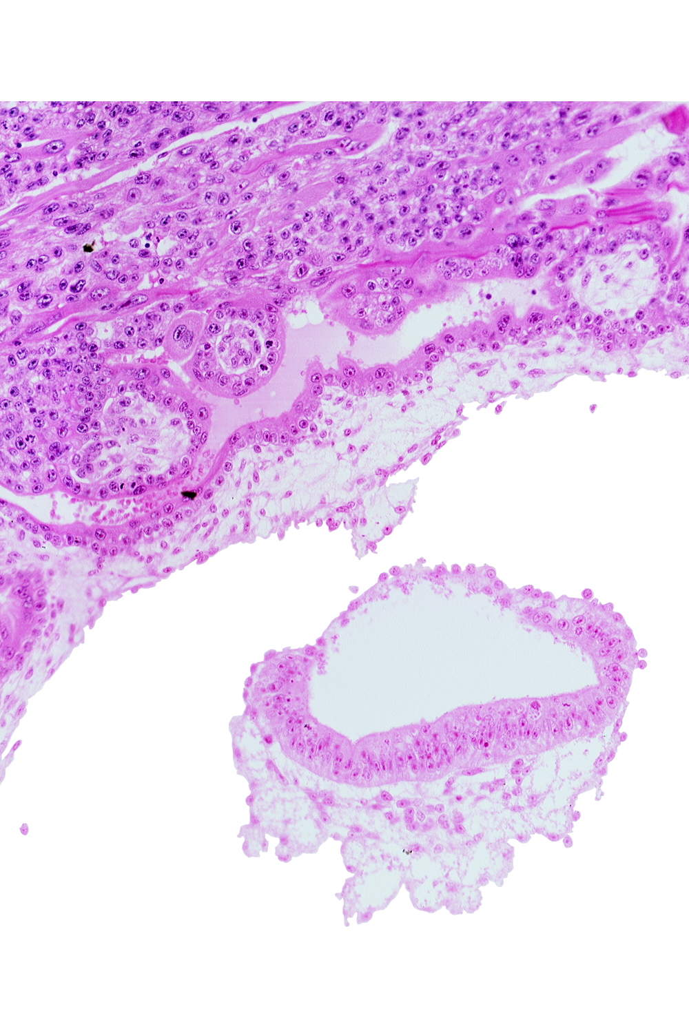 amnion, amniotic cavity, extra-embryonic mesoblast (somatopleuric layer), head mesenchyme