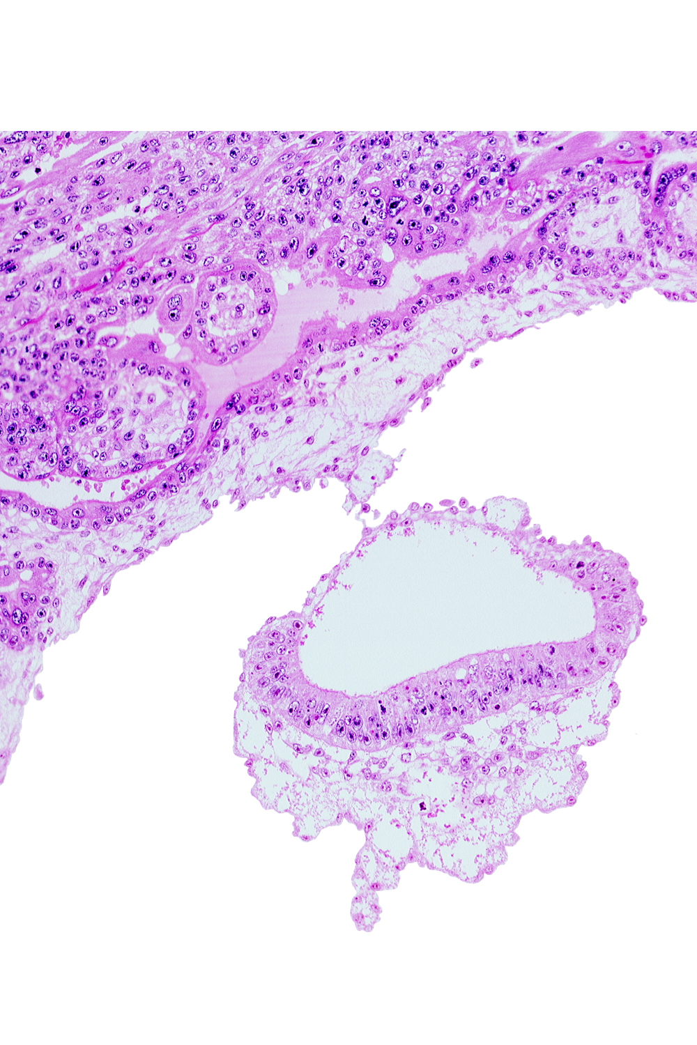amnion, amniotic cavity, embryonic disc, extra-embryonic mesoblast (somatopleuric layer)