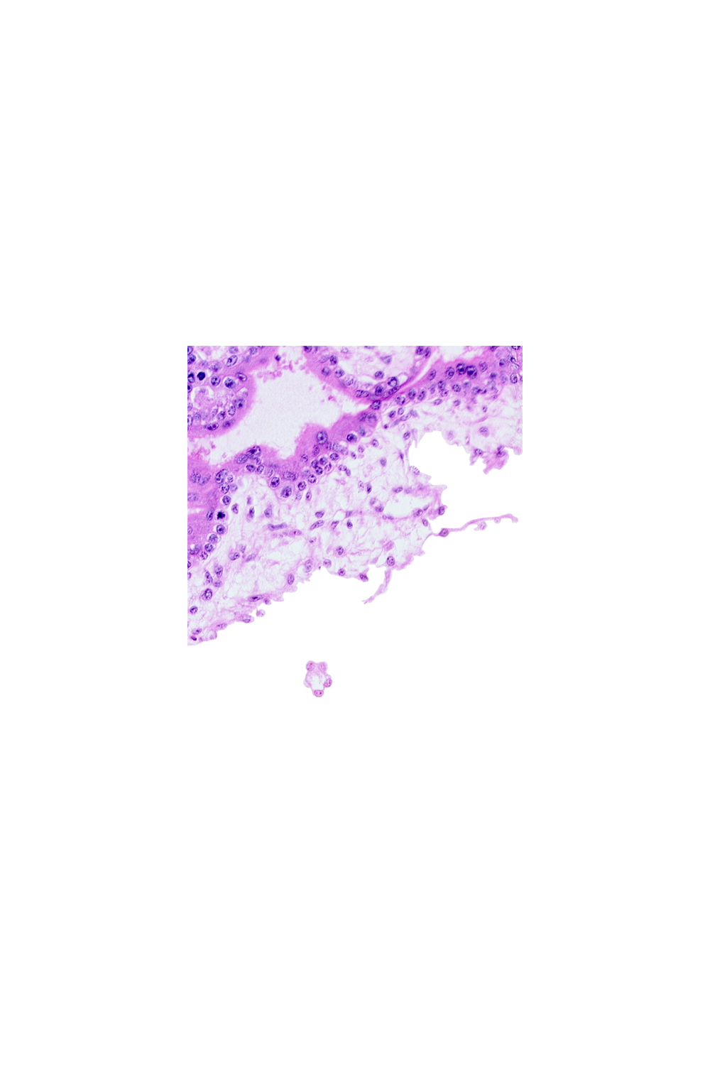 chorion, chorionic cavity (extra-embryonic coelom or exocoelom), extra-embryonic mesoblast, floating villus, intervillus space(s)