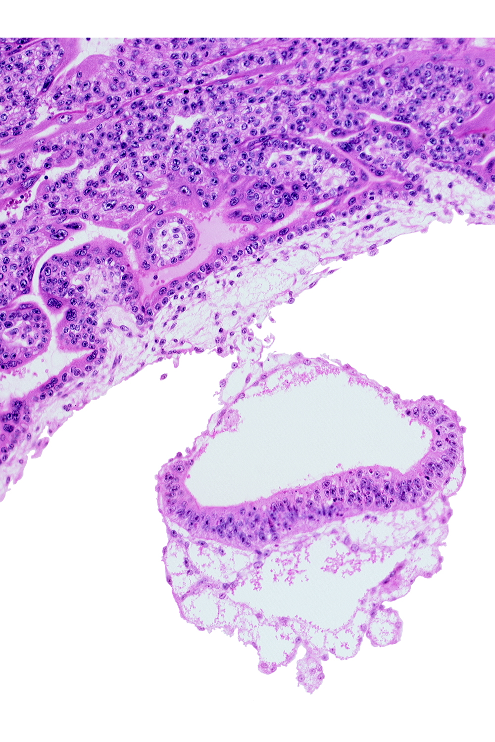 amnion, amniotic cavity, connecting stalk, epiblast, extra-embryonic endoderm, extra-embryonic mesoblast, umbilical vesicle cavity