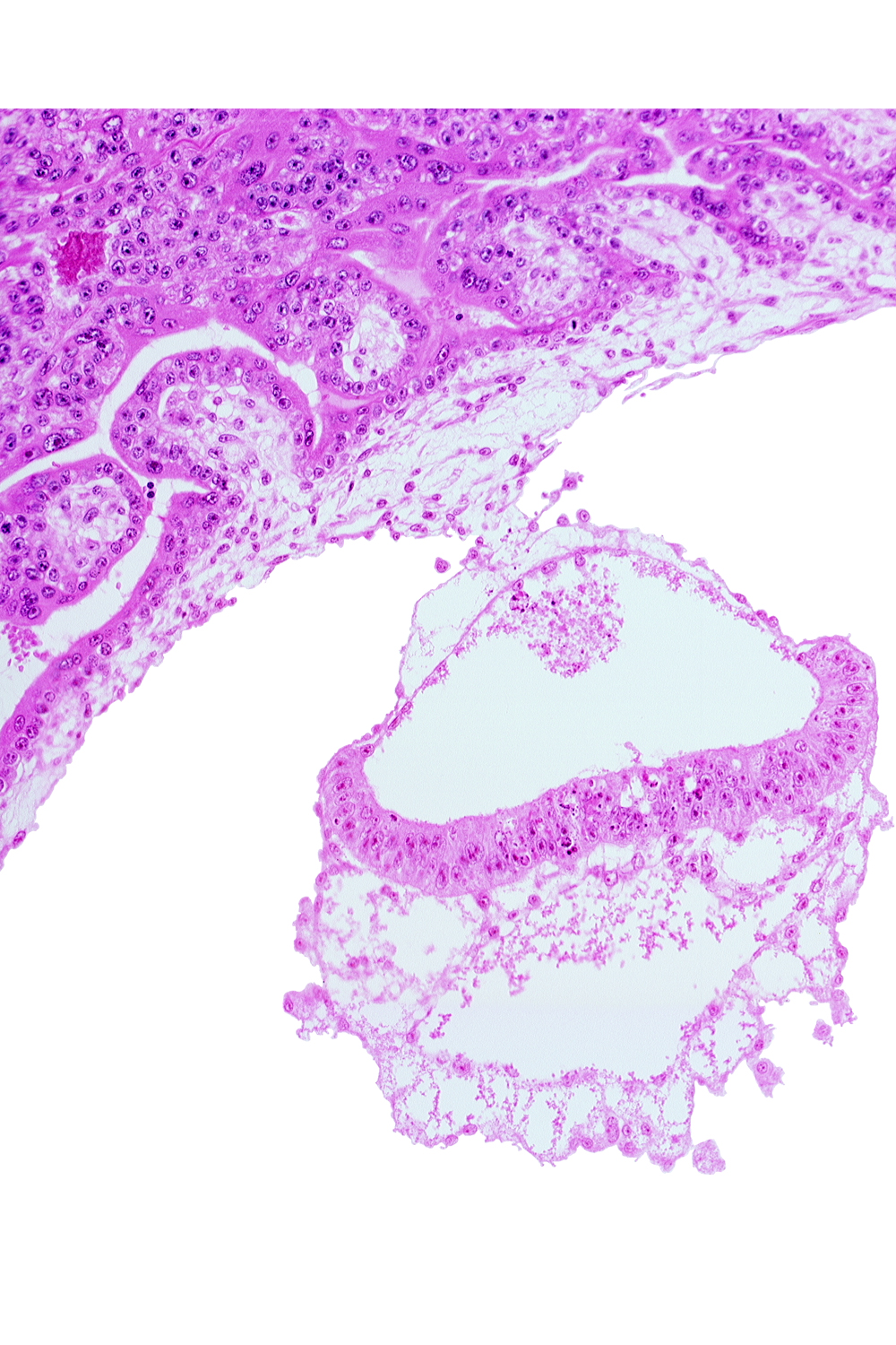 connecting stalk, extra-embryonic coelom, junction of amnion and epiblast plate, two-layered amnion, umbilical vesicle wall