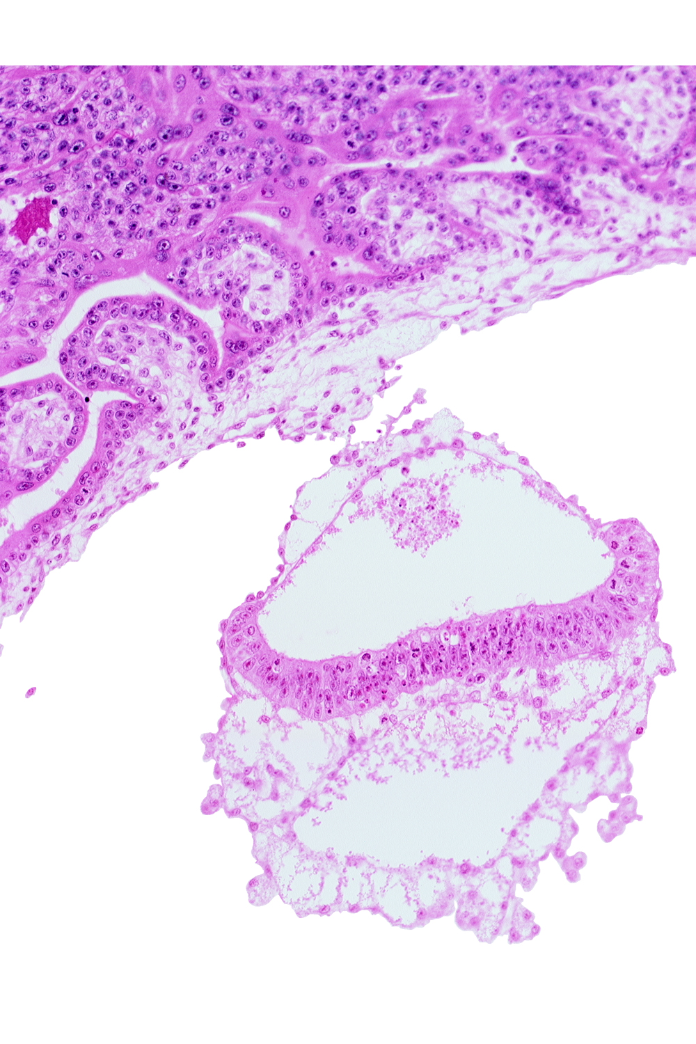 connecting stalk, epiblast, extra-embryonic coelom, head mesenchyme, hypoblast, junction of amnion and epiblast plate, two-layered amnion, umbilical vesicle wall