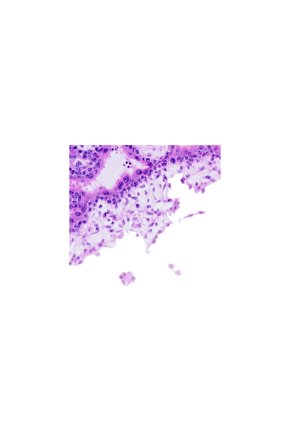 chorionic cavity (extra-embryonic coelom or exocoelom), extra-embryonic mesoblast, floating villus, intervillus space(s)