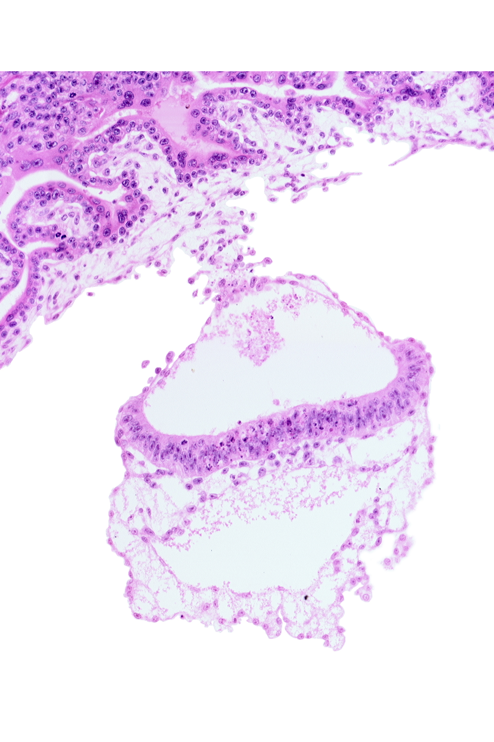 amniotic cavity, cephalic end of notochordal process, head mesenchyme, hemangiogenic tissue, hypoblast, mesothelium of umbilical vesicle, presumptive neural plate, umbilical vesicle cavity