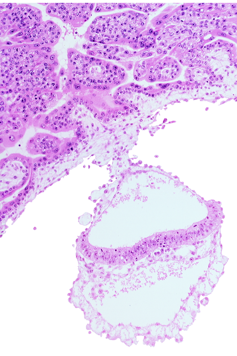 amniotic cavity, connecting stalk, epiblast, hypoblast, notochordal process, presumptive neural plate, umbilical vesicle cavity