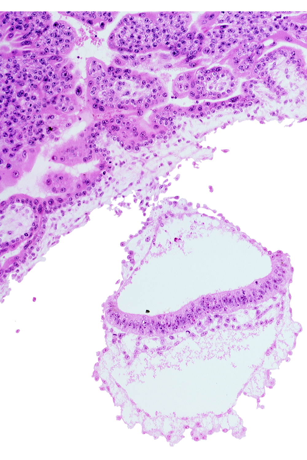 amniotic mesenchyme, epiblast, hemangiogenic tissue, hypoblast, junction of embryonic and extra-embryonic mesoblast, notochordal process, presumptive neural plate, two-layered amnion, umbilical vesicle wall