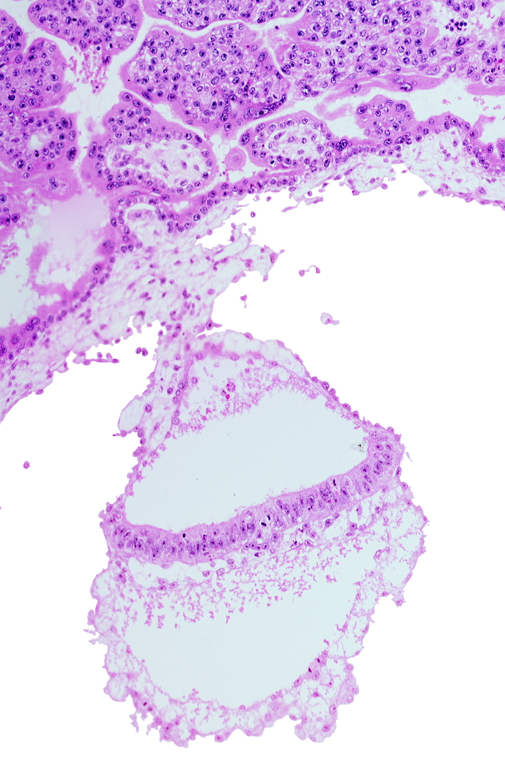 extra-embryonic ectoderm, gastrulation (primitive) node, head mesenchyme, hypoblast, one-layered epiblast