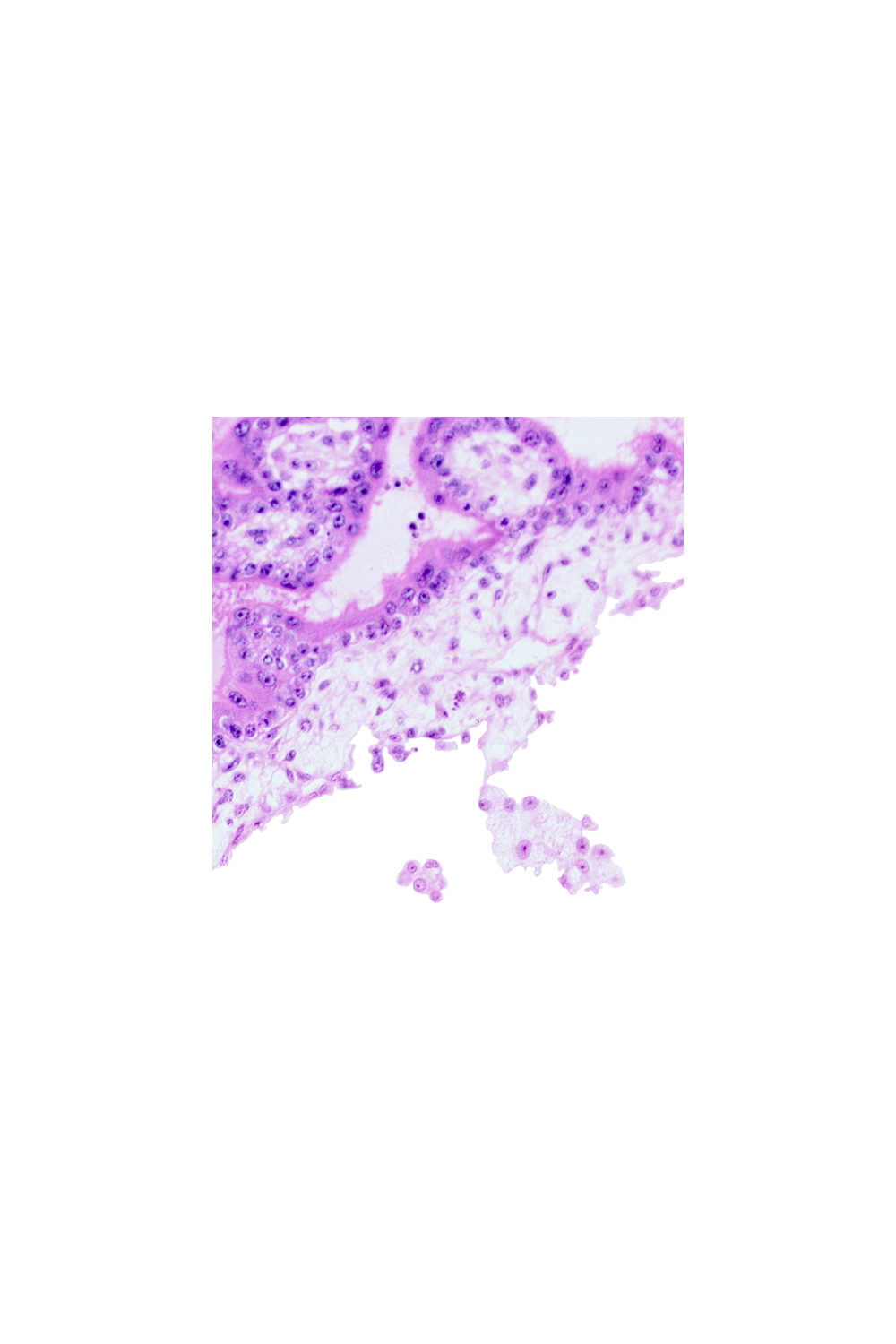 cephalic edge of connecting stalk, chorionic cavity, extra-embryonic mesoblast